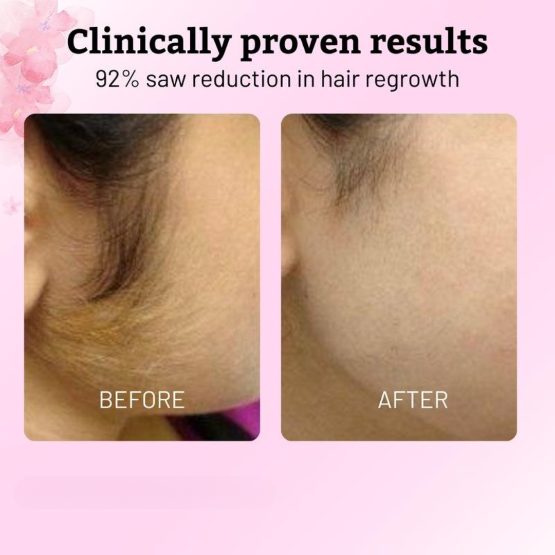 Lucia Glow™ Cyperus Rotundus Oil for Hair Removal