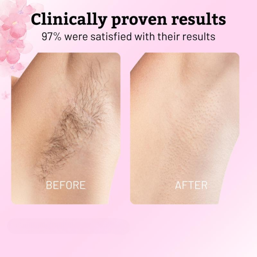 Lucia Glow™ Cyperus Rotundus Oil for Hair Removal